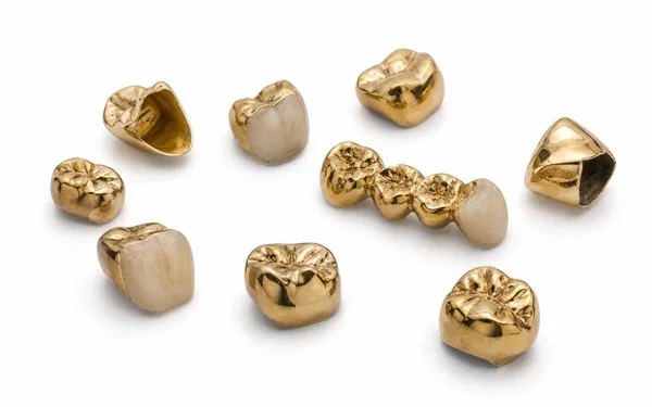 Zahngold Ankauf Schwerin, goldene Zahnkronen und Brücken, teils mit Zähnen
